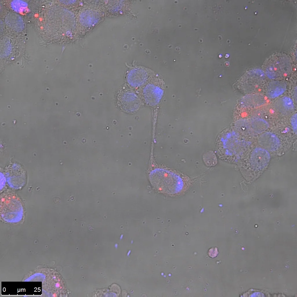 Confocal section showing labelled nanocarriers inside cells.