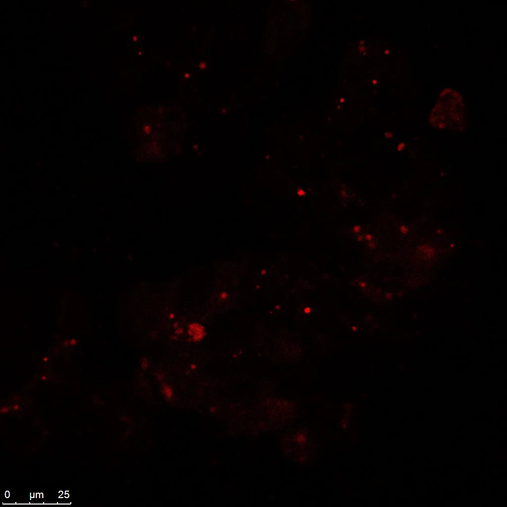 Nanocarrier fluorescence (red channel).