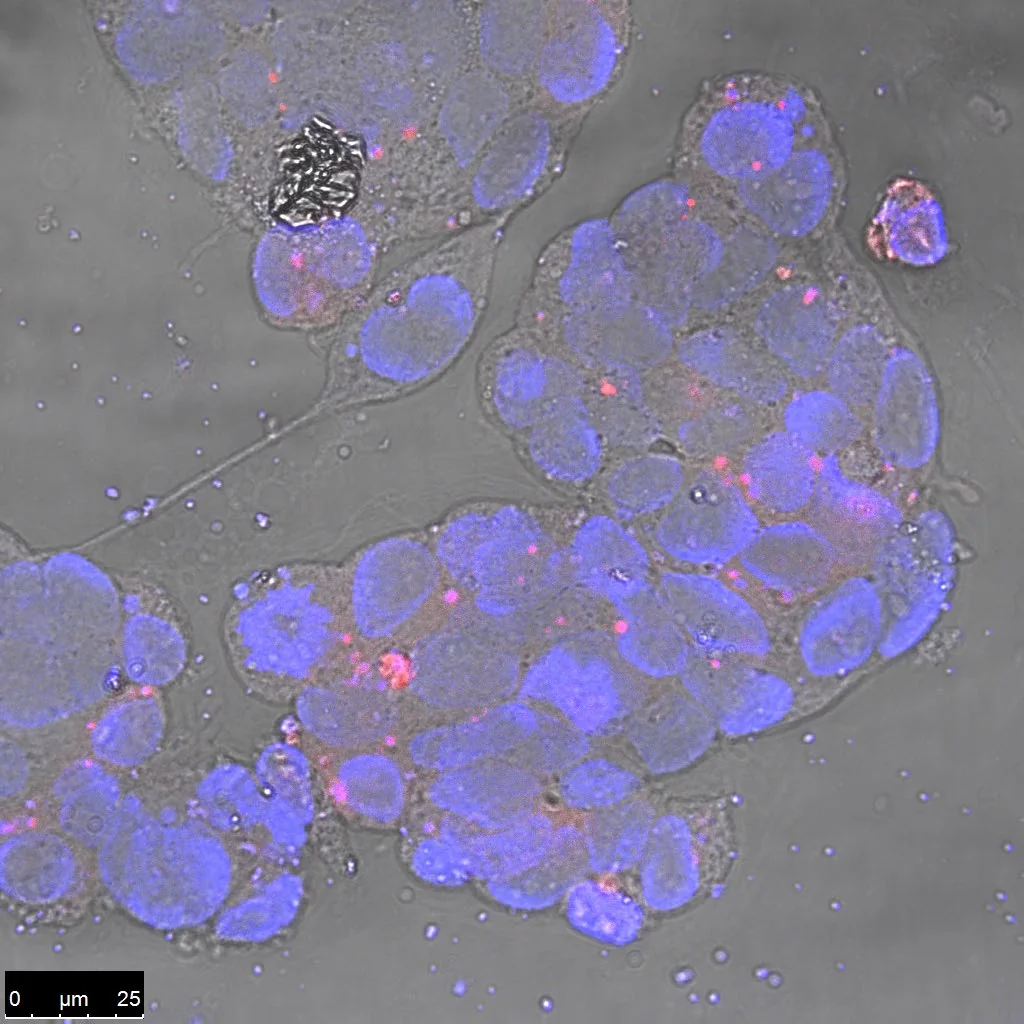 Merged channels with bright field, confirming intracellular localisation.