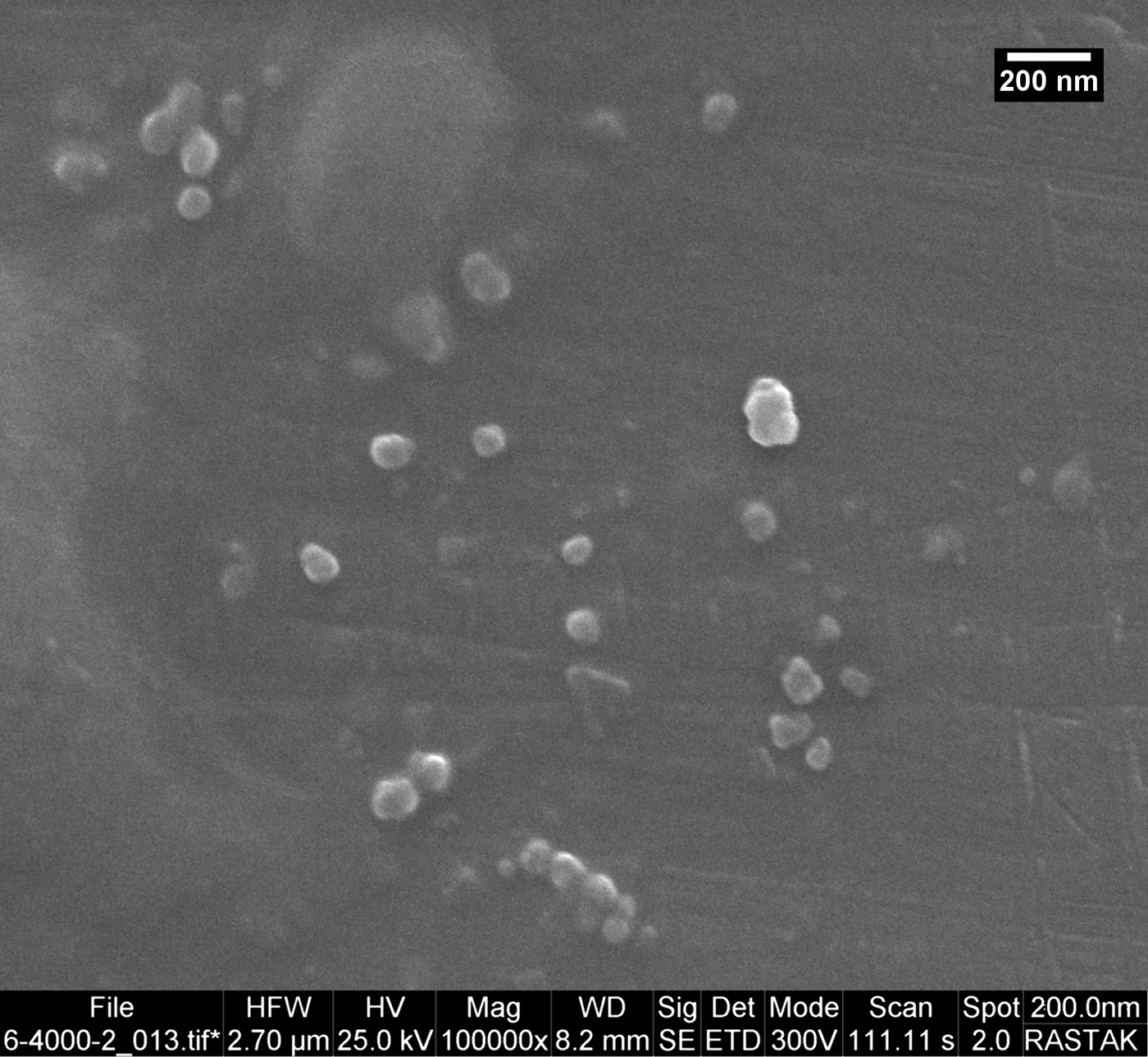 SEM image of the analysed region (100,000×, 25 kV) used to locate nanocarriers for EDS acquisition.